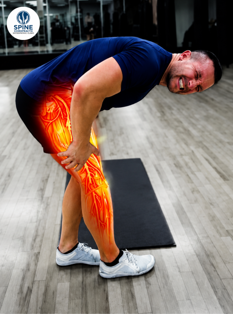 sciatica pain treatment